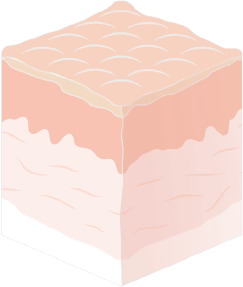 px box 1 Perfection X Red Light Wand